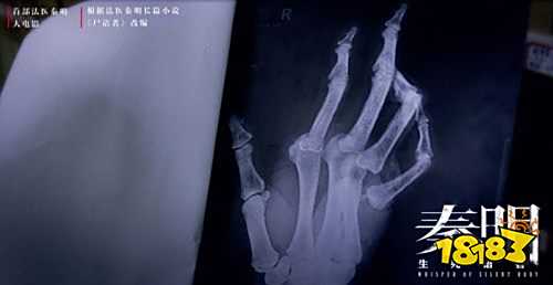 《秦明·生死语者》高清无删减版迅雷下载