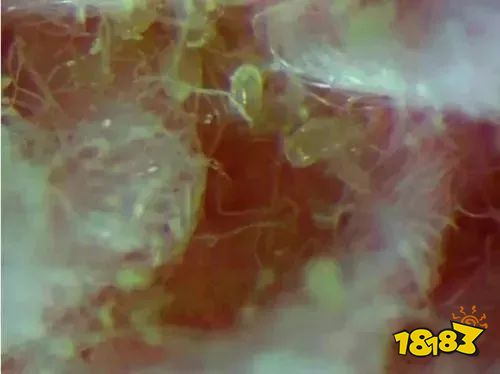 床上放个它，1000W螨虫集体自杀，比太阳暴晒强10000倍，每天不到一毛钱！