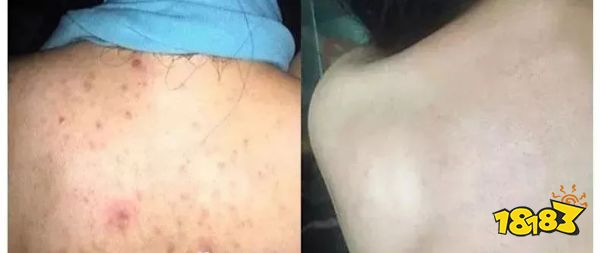 床上放个它，1000W螨虫集体自杀，比太阳暴晒强10000倍，每天不到一毛钱！
