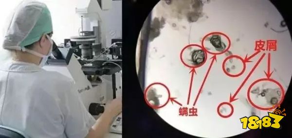 床上放个它，1000W螨虫集体自杀，比太阳暴晒强10000倍，每天不到一毛钱！
