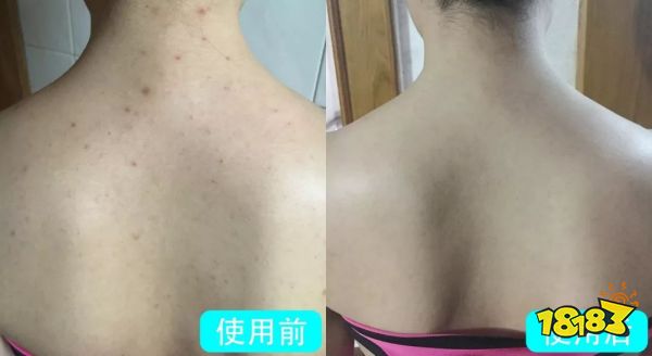 床上喷喷它，让千万螨虫集体自杀，比太阳暴晒强10000倍