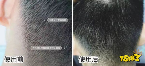 床上喷喷它，让千万螨虫集体自杀，比太阳暴晒强10000倍