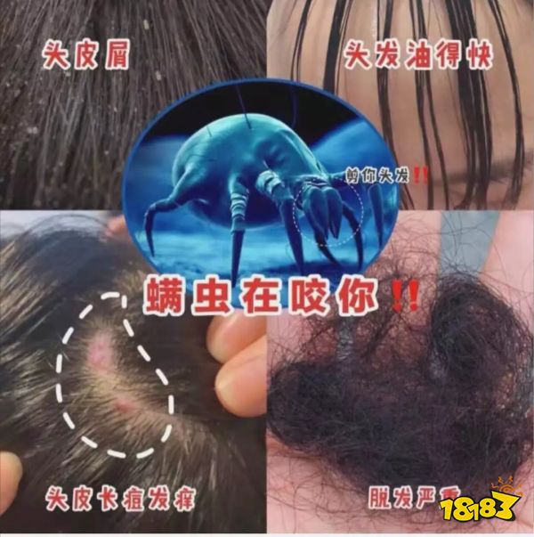 床上喷喷它，让千万螨虫集体自杀，比太阳暴晒强10000倍