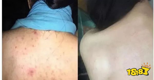 床上喷喷它，让千万螨虫集体自杀，比太阳暴晒强10000倍