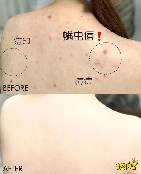 床上喷喷它让千万螨虫集体自杀比太阳暴晒强10000倍