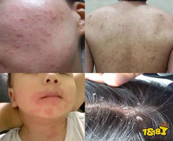 床上喷喷它，让千万螨虫集体自杀，比太阳暴晒强10000倍
