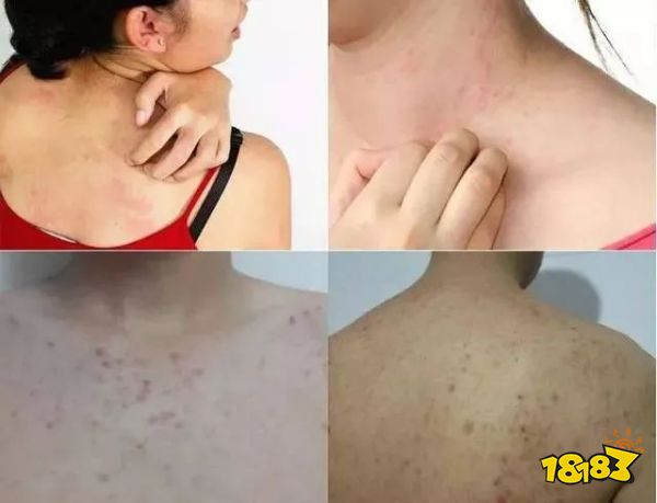 床上喷喷它，让千万螨虫集体自杀，比太阳暴晒强10000倍