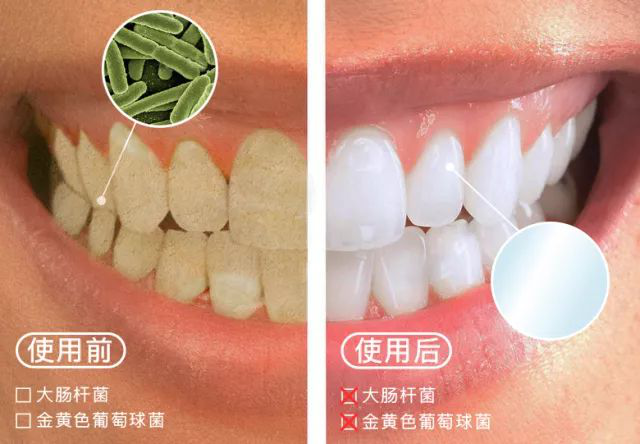 口臭的人，嘴巴里都有这个东西....用它刷牙，连说话都是桂花香!