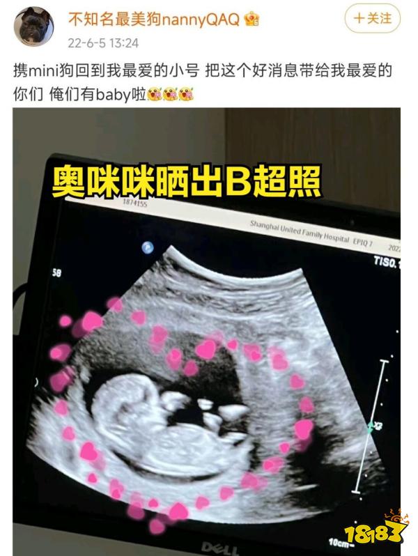 Uzi女朋友怀孕了吗 LOLuzi女友怀孕回应