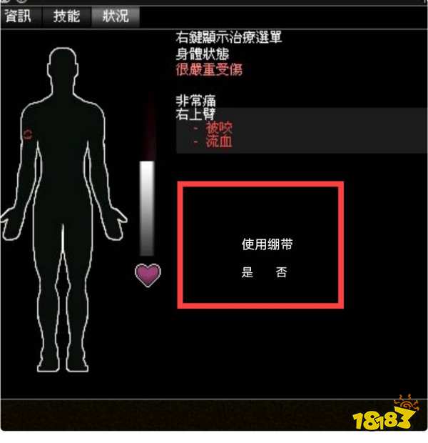 僵尸毁灭工程咬伤必死吗 咬伤解决方法介绍