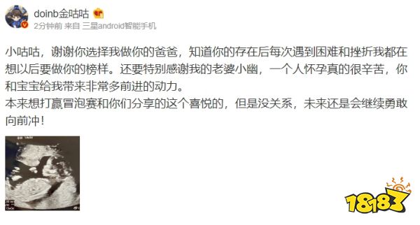 doinb有孩子嗎 doinb當爸爸大喜