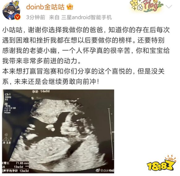 糖小幽懷孕了嗎 糖小幽懷孕介紹