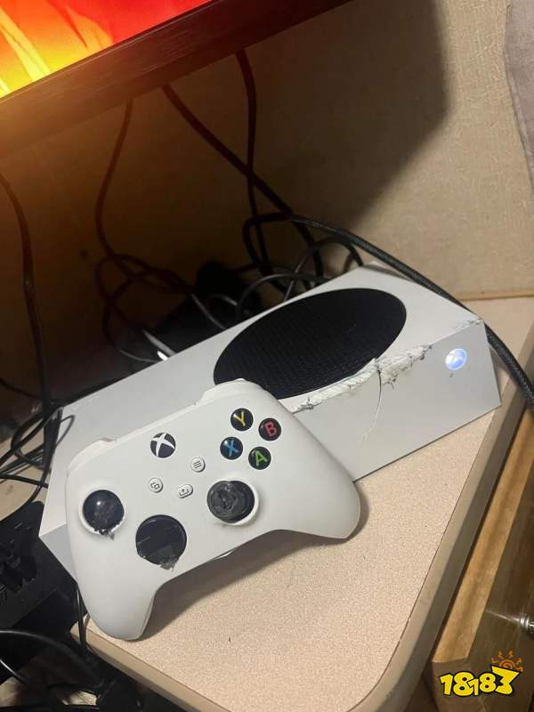 玩家毒舌周刊|就說玩游戲有用吧，玩家被卡車撞倒后被Xbox主機救了一命