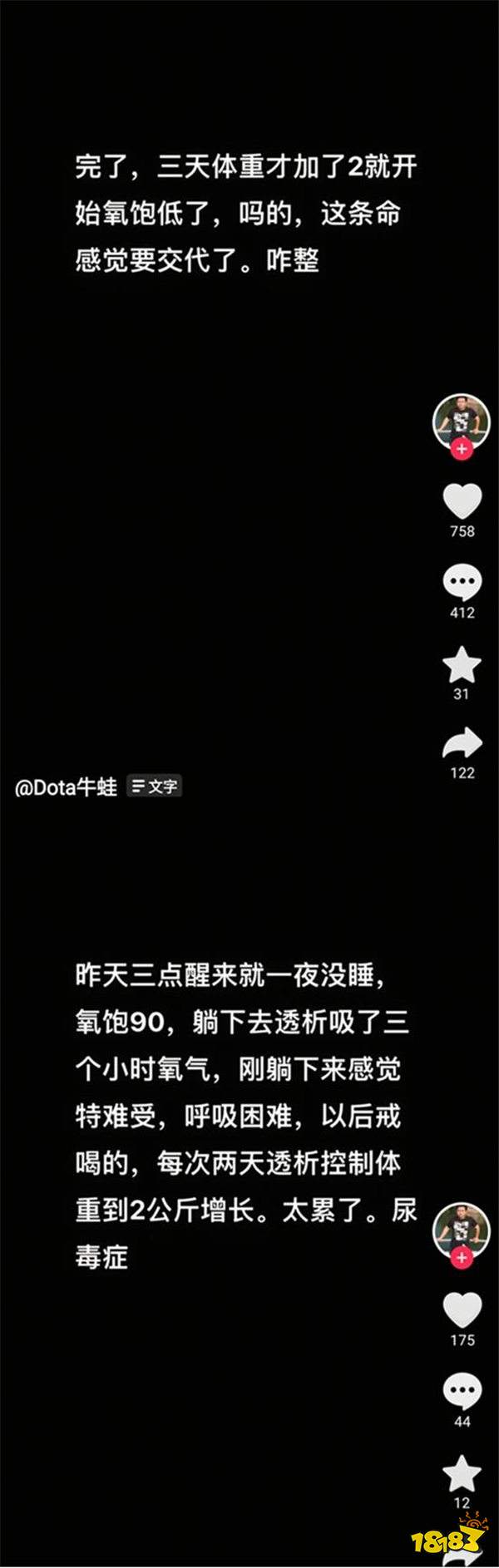 世事难料！著名DOTA主播